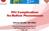 PCI Complication: No-Reflow Phenomenon