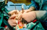 Hospital MV Surgical Volume Not Tied to TMVr Outcomes