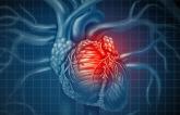 No ‘Obesity Paradox’: BMI and Infarct Size Not Linked in STEMI