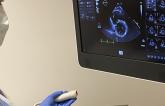 Echo During COVID-19? New Advice Weighs Doctor Safety, Patient Needs
