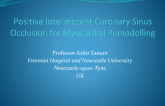 Positive Intermittent Coronary Sinus Occlusion for Myocardial Remodelling 