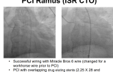 Left Main PCI with Co-Morbidities A New Zero Contrast Approach