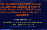 First Prospective Randomized Clinical Trial Assessing Incidence of Reduced Leaflet Motion and its Clinical Impact Following Transcatheter Aortic Valve Implantation 
