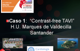 Caso 1: “Contrast-free TAVI” 