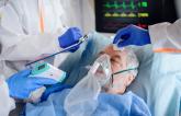 COVID-19 Clots Spur Both Arterial, Venous Events in Hospitalized Patients