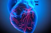 Higher BP May Limit Myocardial Injury in AMICS
