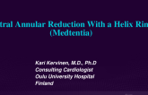 Mitral Annular Reduction With a Helix Ring (Medtentia)