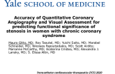 TCT 208: Accuracy of Quantitative Coronary Angiography and Visual Assessment for Predicting Functionally Significant Stenoses in Women With Chronic Coronary Syndrome