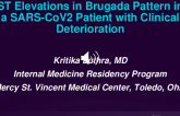 TCT 532: ST Elevations in Brugada Pattern in a SARS-CoV2 Patient With Clinical Deterioration