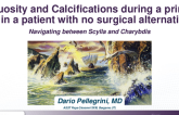 TCT 591: Tortuosity and Calcifications During a Primary PCI in a Patient With no Surgical Alternatives: Navigating Between Scylla and Charybdis