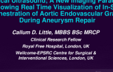 TCT 373: Optical Ultrasound; A New Imaging Paradigm Allowing Real Time Visualization of In-Situ Fenestration of Aortic Endovascular Grafts During Aneurysm Repair