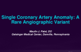 TCT 662: Single Coronary Artery Anomaly: A Rare Angiographic Variant
