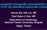 TCT 571: Successful Retrograde Recanalization of RCA CTO via Ipsilateral Epicardial Collaterals