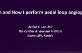 When and How I Perform Pedal Loop Angioplasty