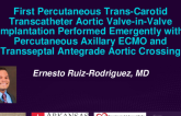 TCT 543: First Percutaneous Trans-Carotid Transcatheter Aortic Valve-in-Valve Implantation Performed Emergently With Percutaneous Axillary Extracorporeal Membrane Oxygenation Life Support and Transseptal Antegrade Aortic Crossing