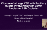 TCT 575: Percutaneous Closure of a Large Post-infarct Ventricular Septal Defect in a High Surgical Risk Patient