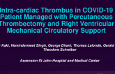 TCT 538: Large Intra-Cardiac Thrombus in a COVID-19 Patient Managed With Percutaneous Thrombectomy and Right Ventricular Mechanical Circulatory Support