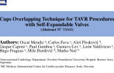TCT 129: Cups Overlapping Technique for TAVR Procedures With Self-Expandable Valves