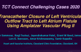 TCT 557: Transcatheter Closure of Left Ventricular Outflow Tract to Left Atrium Fistula Using Amplatzer Vascular Plug II