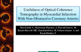 TCT 325: Usefulness of Optical Coherence Tomography in Myocardial Infarction With Non-Obstructive Coronary Arteries