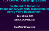 TCT 617: Treatment of Subaortic Pseudoaneurysm With Transcatheter Aortic Valve Replacement