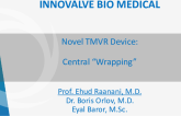 Central Chordal Wrapping for TMVR (Innovalve)