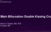 TCT 616: Left Main Bifurcation Stenting Using Double Kissing Crush