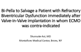 TCT 536: Bi-Pella to Salvage a Patient With Refractory Biventricular Dysfunction Immediately After Valve-in-Valve Implantation in Whom ECMO was Contra-Indicated