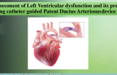 TCT 201: Assessment of LV Dysfunction and its Predictors Following Catheter Guided Patent Ductus Arteriosus Device Closure
