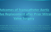 TCT 143: Outcomes of Transcatheter Aortic Valve Replacement After Prior Mitral Valve Surgery
