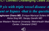TCT 663: 29 y/o With Triple Vessel Disease -To Stent or Bypass That is the Question