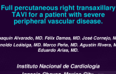 TCT 613: Full percutaneous Right Transaxillary TAVI for a Patient With Severe Peripheral Vascular Disease