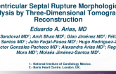 TCT 439: Ventricular Septal Rupture Morphological Analysis by Three-Dimensional Tomographic Reconstruction
