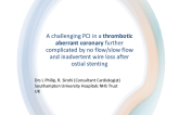 TCT 560: A Challenging PCI in a Thrombotic Aberrant Coronary in The Setting of a Myocardial Infarction Further Complicated by no Flow/Slow Flow and Inadvertent Wire Loss After Ostial Stenting