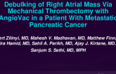 TCT 518: Debulking of Right Atrial Mass Via Mechanical Thrombectomy With Angiovac in a Patient With Metastatic Pancreatic Cancer