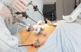 Bariatric Surgery Tied to Better Long-term Outcomes After MI 