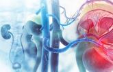 Treating Accessory Arteries May Be Important in Renal Denervation