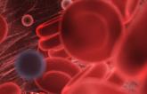 Study Affirms Thrombotic Risk in COVID-19