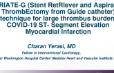 TCT 552: “STRIATE-G (Stent RetRIever and Aspiration ThrombEctomy From Guide Catheter)” Technique for Large Thrombus Burden/ COVID-19 ST- Segment Elevation Myocardial Infarction