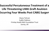 TCT 528: Successful Percutaneous Treatment of a Catastrophic Left Internal Mammary Artery Graft Avulsion Occurring Four Weeks post Coronary Artery Bypass Grafting Surgery.