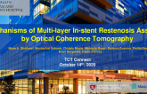 TCT 409: Mechanisms of Multi-layer In-stent Restenosis Assessed by Optical Coherence Tomography