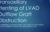 TCT 500: Transaxillary Stenting of LVAD Outflow Graft Obstruction
