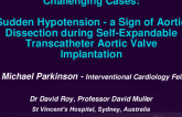 TCT 559: Sudden Hypotension - A Sign of Aortic Dissection during Self-Expandable Transcatheter Aortic Valve Implantation
