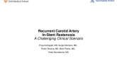 TCT 694: Recurrent Carotid Artery In-Stent Restenosis - A Challenging Clinical Scenario