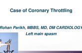 TCT 627: Case of Coronary Throttling