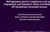 TCT 649: Self-Apposing Stents in Saphenous Vein Graft Angioplasty and Rotastent: Utility of Bi-Distal and 8Fr-Sheathless Transradial Access