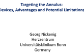FMR: Targeting the Annulus: Devices, Advantages, and Potential Limitations