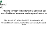 TCT 563: “Railing Through the Aneurysm”; Extensive Coil Embolization of a Coronary Artery Pseudoaneurysm