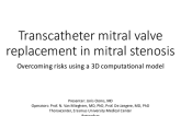 TCT 564: Transcatheter Mitral Valve Replacement in Mitral Stenosis - Overcoming Risks Using a 3D Computational Model