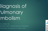 Diagnosis of Pulmonary Embolism